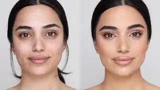 Flawless Foundation on Acne Scarred Skin | Hindash