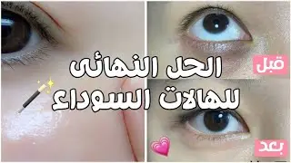 العناية الصينيه 🇨🇳 تخلصي من الهالات بدون لاتشتري أي منتج تجميلي🤚🏻😯( ينفع لكل الأعمار )