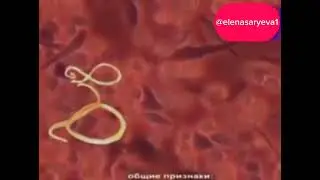 Влияют ли паразиты на суставы?
