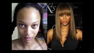 15 Celebrities Without Makeup