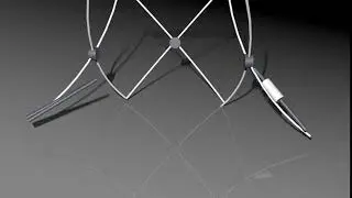 Spreader Rod Systems