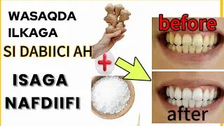 wasaqda Ilkaha si Dabiici ah isaga Nadiifi @xogocaafimaad