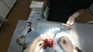 Линейное инородное тело в пищеварительном тракте Linear foreign body in the digestive tract