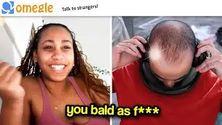 Everyone is Flaming my Hair Transplant on Monkey App