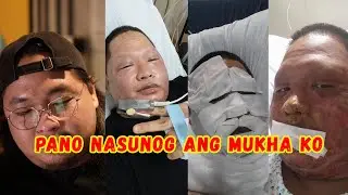 PANO NASUNOG ANG MUKHA KO | Ninong Ry