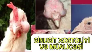 Küçələrdə sunisit xəstəliyi nədən olur və müalicəsi ❗