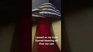 My Knee Started Bleeding Everywhere