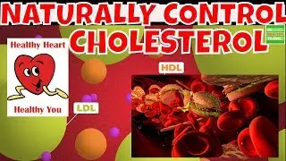 How To Control Cholesterol Levels Naturally.