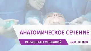 Анатомическое сечение от доктора Копасова