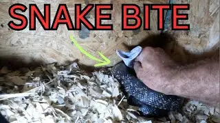 Snake Bite when catch goes wrong #snakebite #viral