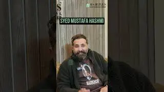 Syed Mustafa Hashmi's Hair Transplant Journey!