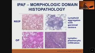 Optimizing outcomes in IMIDs: Focus on Co-Morbidities