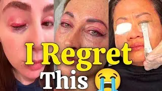 Permanent Eyeliner Tattoo: Regrets, Removal & Pain