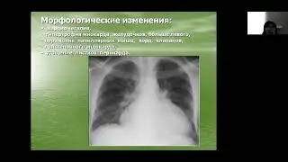 кардит 1 часть