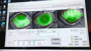 Using The Smap3D Computer To Help Us Design A Latitude Scleral Lens