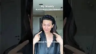 My Blackhead & Whitehead Removal Facial At Home