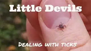 Tick Bite Prevention : Top Tips You Need To Know