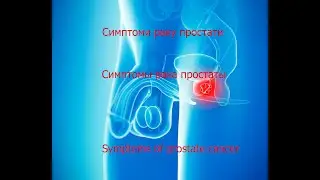 Важные симптомы рака простаты