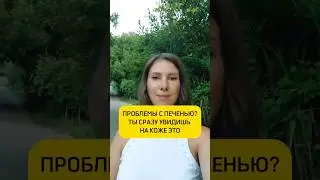 Проблемы с печенью?Ты сразу увидишь на коже это