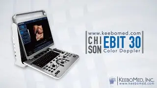 The Most Affordable Chison EBit 30 Portable Color Doppler Ultrasound Machine | KeeboMed