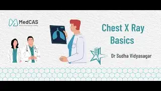 Chest X Ray basics By Professor Sudha Vidyasagar