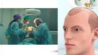 Hair Transplant Centers: Leading Clinics Reviewed İn İstanbul