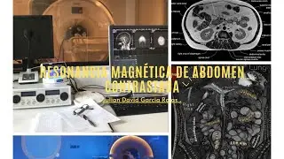 Resonancia magnética de abdomen contrastada