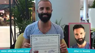 Elite Hair Transplant 🇬🇧 - زراعة الشعر - Elite Hair Turkey - Saç Ekim Merkezi - İstanbul