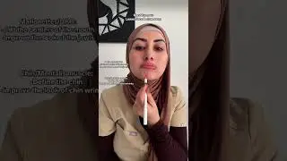 Lower face Botox