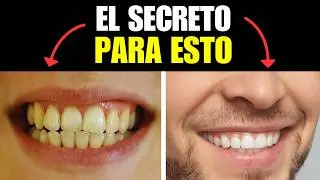 El Secreto para Dientes Blancos que Te Sorprenderá