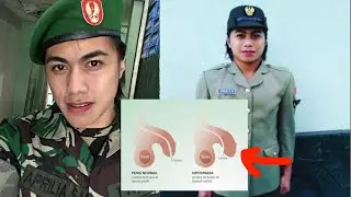 Penjelasan aprilia manganang kenapa dari perempuan bisa jadi laki-laki