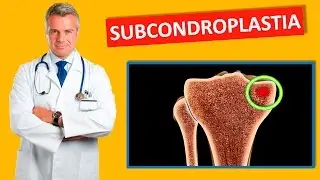 SUBCONDROPLASTIA PARA O JOELHO
