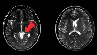 First Brain Scan of Dying Man Reveals a Unexpected Secret !