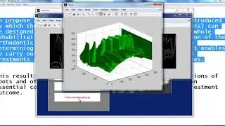 matlab project ideas for beginners | matlab thesis ideas for beginners