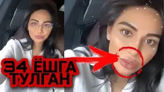 Лабини Килдирган МУНИСАГА ЖОНЛИ ЭФИРДА КАРИБ КОПСИЗ ДЕЙИШДИ