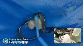 Кариес V-класс 13 EmpressDirect Syntec Sanctuary (прямой эфир)