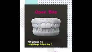 Yang mana kondisi gigi kamu? 😁