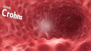360° VR animation | inside the GI tract