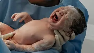 Nascimento Erasmo - Perinatal Barra