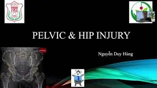 Tiếp cận chẩn đoán hình ảnh X-Quang chấn thương khung chậu và khớp háng - BS. Nguyễn Duy Hùng