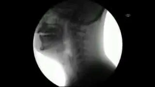 Yiyip içerken X Ray cihazında nasıl gözükürüz?
