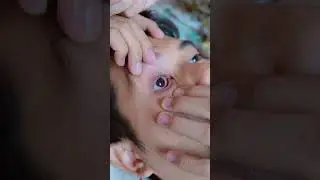 Aletha Kebanyakan Kasih Obat Ke Papoy 