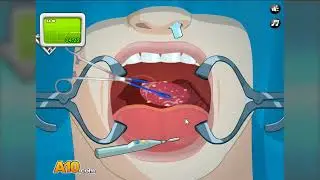 Operate Now: Tonsil Surgery (Walkthrough)