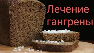 Лечение гангрены заговором.