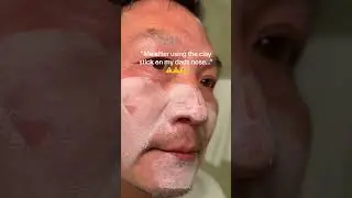 ⚠️MY DADS NOSE⚠️