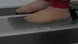 Диагностика плоскостопия у детей и взрослых.