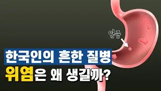 한국인의 흔한 질병, 위염은 왜 생길까? 위염의 원인과 치료 방법｜허봉수 원장