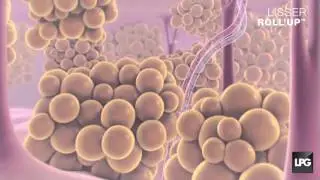 endermologie® Corps