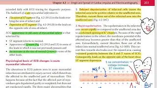 ecg 7