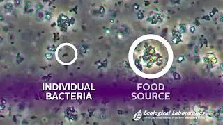 MICROBE-LIFT Microbial Consortium Under the Microscope!